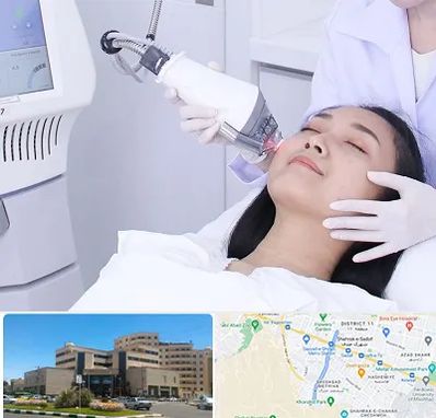 وایتنینگ در صیاد شیرازی مشهد