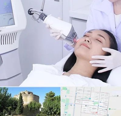 وایتنینگ در مرداویج اصفهان