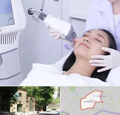 وایتنینگ در دزاشیب