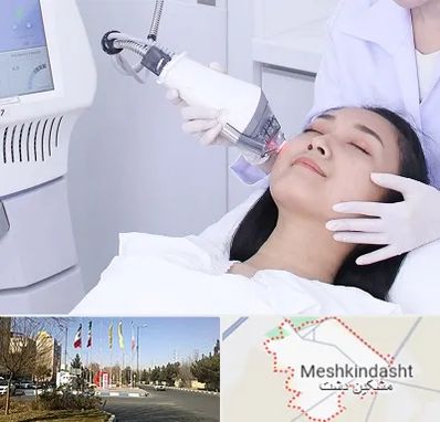 وایتنینگ در مشکین دشت