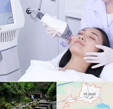 وایتنینگ در علی آباد کتول