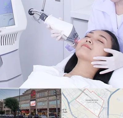 وایتنینگ در قائمیه اسلامشهر