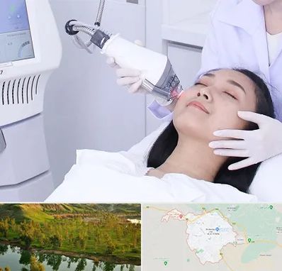 وایتنینگ در بهبهان