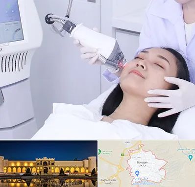 وایتنینگ در برازجان