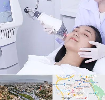 وایتنینگ در معالی آباد شیراز