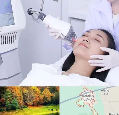 وایتنینگ در کردکوی