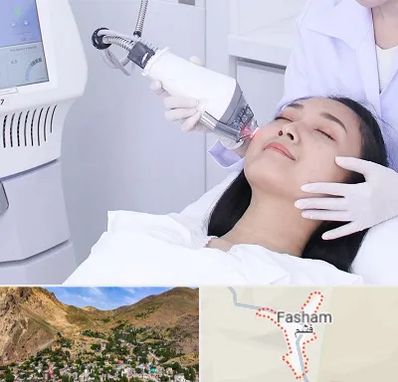 وایتنینگ در فشم