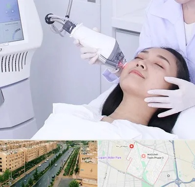 وایتنینگ در فاز سه اندیشه