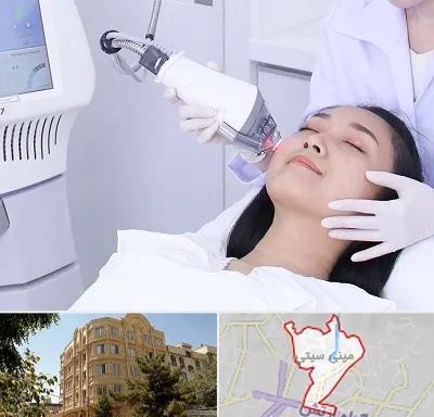 وایتنینگ در مینی سیتی