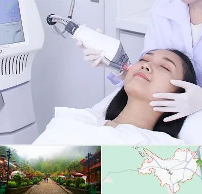 وایتنینگ در فومن