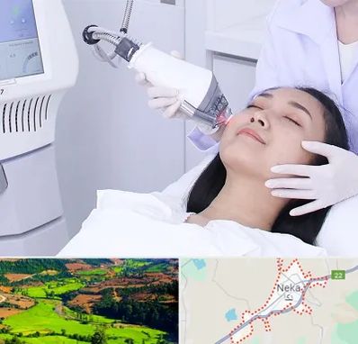 وایتنینگ در نکا