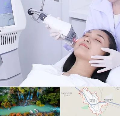 وایتنینگ در دورود