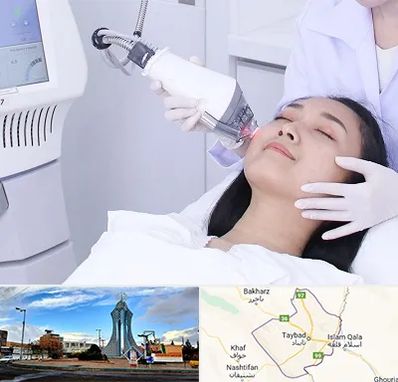 وایتنینگ در تایباد