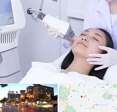 وایتنینگ در بلوار سجاد مشهد