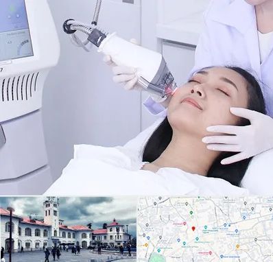 وایتنینگ در میدان شهرداری رشت