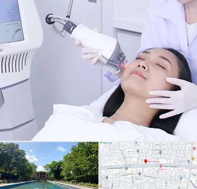 وایتنینگ در هشت بهشت اصفهان