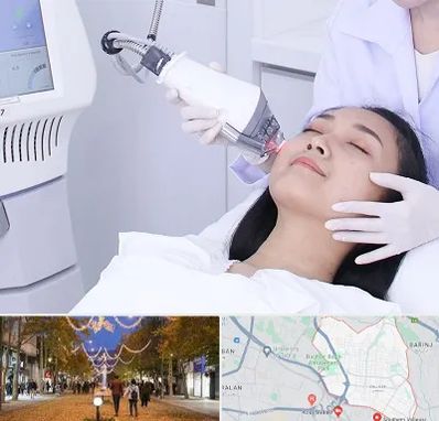 وایتنینگ در ولیعصر ارومیه