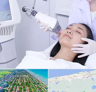 وایتنینگ در فریدونکنار