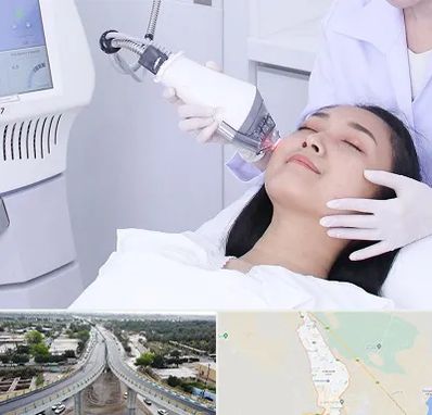 وایتنینگ در اندیمشک