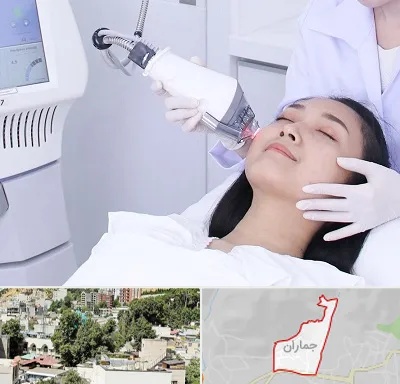 وایتنینگ در جماران