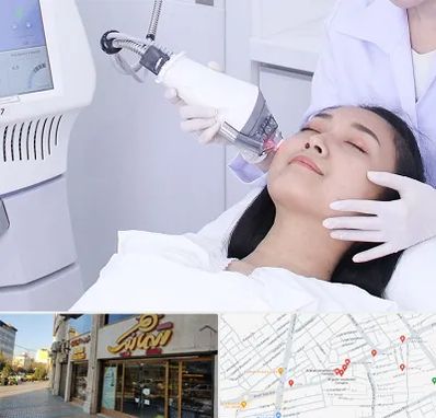 وایتنینگ در عطاران قم