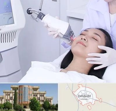 وایتنینگ در دهدشت