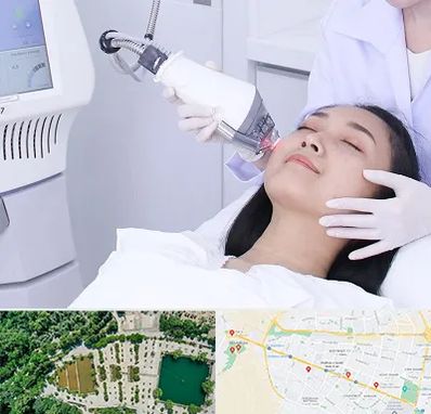 وایتنینگ در وکیل آباد مشهد