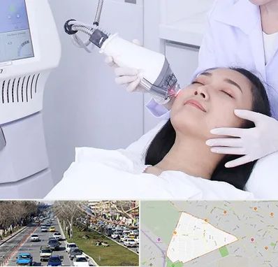 وایتنینگ در احمدآباد مشهد