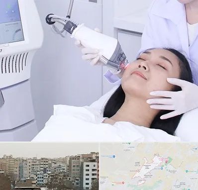 وایتنینگ در محمد شهر کرج