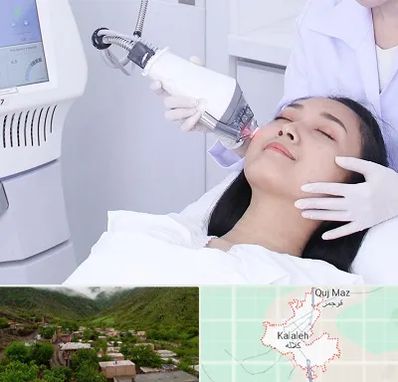 وایتنینگ در کلاله