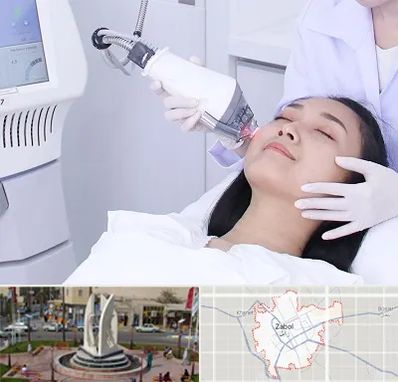وایتنینگ در زابل