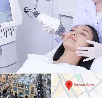 وایتنینگ در بازار رضا مشهد