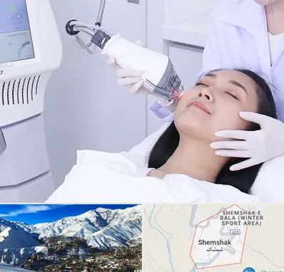 وایتنینگ در شمشک