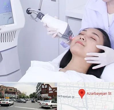 وایتنینگ در خیابان آذربایجان