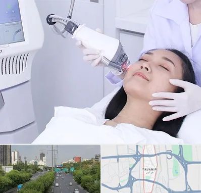 وایتنینگ در توانیر