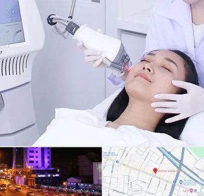 وایتنینگ در آبرسان تبریز