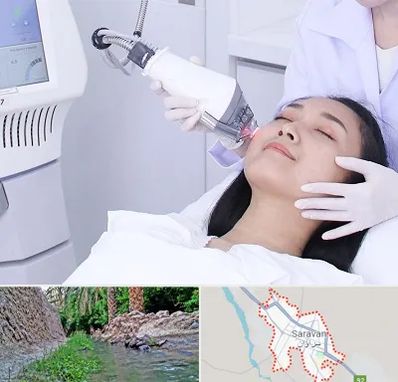 وایتنینگ در سراوان