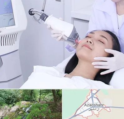 وایتنینگ در آزادشهر