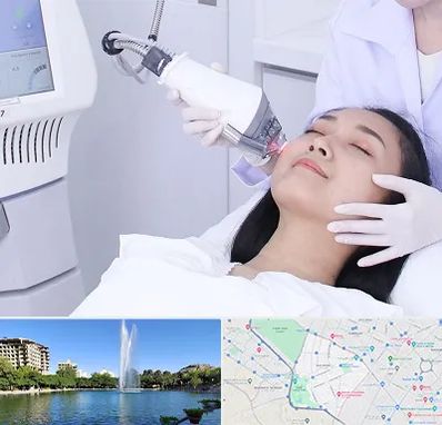 وایتنینگ در کوهسنگی مشهد