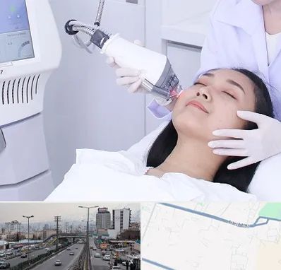 وایتنینگ در بلوار ارتش