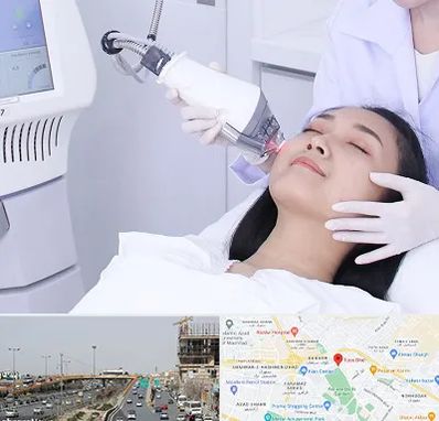 وایتنینگ در بلوار توس مشهد