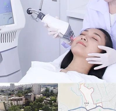 وایتنینگ در اوین