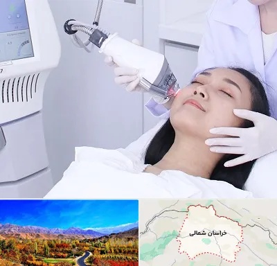 وایتنینگ در خراسان شمالی