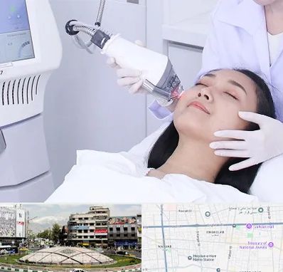 وایتنینگ در مرکز تهران