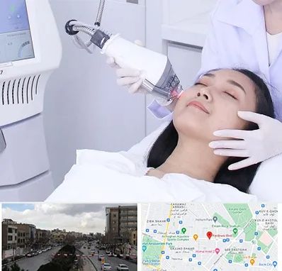 وایتنینگ در بلوار فردوسی مشهد