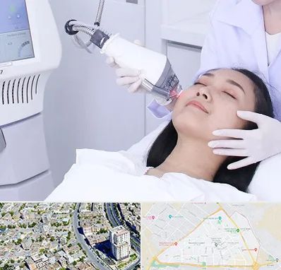 وایتنینگ در قاسم آباد مشهد