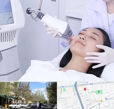 وایتنینگ در کوی فیروز تبریز