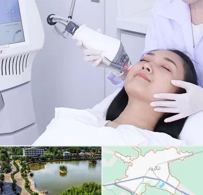 وایتنینگ در لنگرود