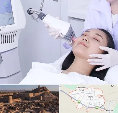 وایتنینگ در بم