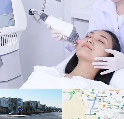 وایتنینگ در شریعتی مشهد